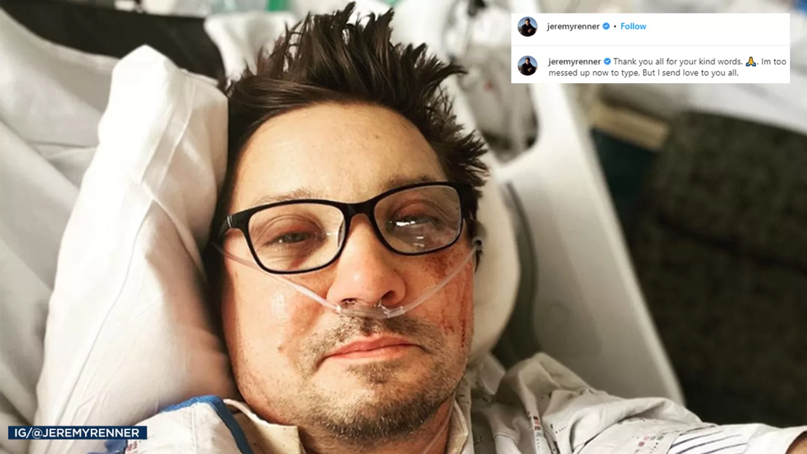 Jeremy Renner update: 'Avengers' star injured by own snowplow while helping stranded family member