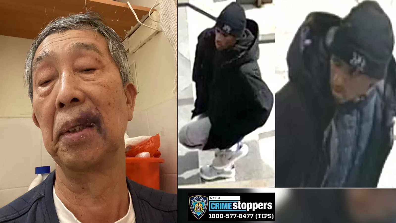 NYC crime: 72-year-old man speaks out after random attack on street in Elmhurst, Queens